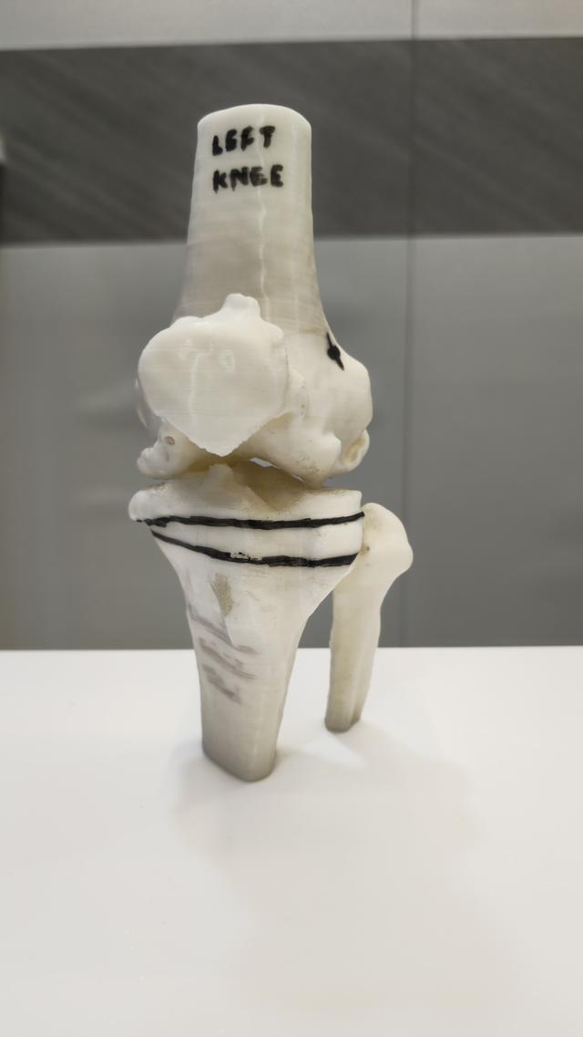 3D Bone Model