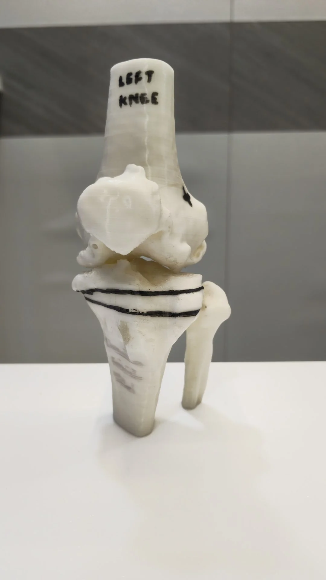 3D Bone Model